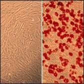 Human Marrow Stromal Cells: HMSC, fetal