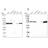 Anti-PRPF19 antibody produced in rabbit Prestige Antibodies® Powered by Atlas Antibodies, affinity isolated antibody, buffered aqueous glycerol solution