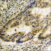 Anti-phospho-NF-kappaB p65 (pSer276) antibody produced in rabbit affinity isolated antibody