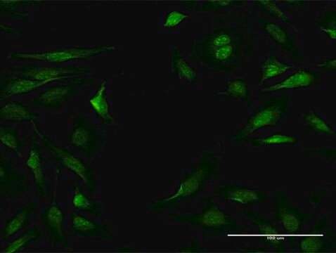 Anti-NLK antibody produced in mouse purified immunoglobulin, buffered aqueous solution