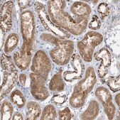 Anti-RAB17 antibody produced in rabbit Prestige Antibodies&#174; Powered by Atlas Antibodies, affinity isolated antibody, buffered aqueous glycerol solution