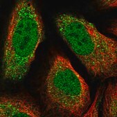 Anti-ACTRT3 antibody produced in rabbit Prestige Antibodies&#174; Powered by Atlas Antibodies, affinity isolated antibody, buffered aqueous glycerol solution