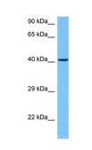 Anti-KLF8 (AB2) antibody produced in rabbit affinity isolated antibody