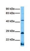 Anti-GSTM3 antibody produced in rabbit affinity isolated antibody
