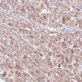 Anti-TMEM246 antibody produced in rabbit Prestige Antibodies® Powered by Atlas Antibodies, affinity isolated antibody, buffered aqueous glycerol solution