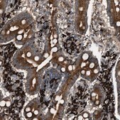 Anti-BAIAP2L1 antibody produced in rabbit Prestige Antibodies&#174; Powered by Atlas Antibodies, affinity isolated antibody, buffered aqueous glycerol solution, Ab2