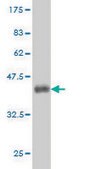 Monoclonal Anti-TP53 antibody produced in mouse clone 2C3, purified immunoglobulin, buffered aqueous solution