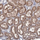 Anti-FBP1 antibody produced in rabbit Prestige Antibodies&#174; Powered by Atlas Antibodies, affinity isolated antibody, buffered aqueous glycerol solution