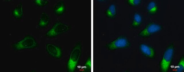 Monoclonal Anti-Ribosome binding protein 1 antibody produced in mouse clone GT5610, affinity isolated antibody