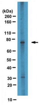 Anti-CPT1A Antibody serum, from rabbit