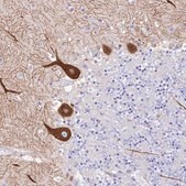 Anti-TAC3 antibody produced in rabbit Prestige Antibodies&#174; Powered by Atlas Antibodies, affinity isolated antibody, buffered aqueous glycerol solution