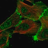 Anti-ERBIN antibody produced in rabbit Prestige Antibodies&#174; Powered by Atlas Antibodies, affinity isolated antibody