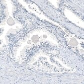 Monoclonal Anti-AGER antibody produced in mouse Prestige Antibodies® Powered by Atlas Antibodies, clone CL10587, purified antibody (Protein A)
