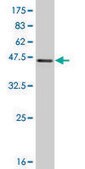 Monoclonal Anti-RP6-213H19.1 antibody produced in mouse clone 3G5, purified immunoglobulin, buffered aqueous solution