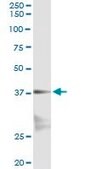 Monoclonal Anti-NKX2-5 antibody produced in mouse clone 3C1, purified immunoglobulin, buffered aqueous solution