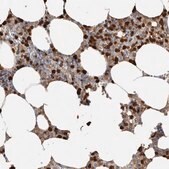 Anti-S100A8 antibody produced in rabbit Prestige Antibodies&#174; Powered by Atlas Antibodies, affinity isolated antibody, buffered aqueous glycerol solution