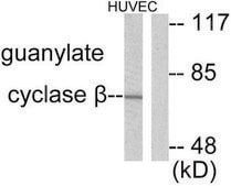 Anti-Guanylate Cyclase &#946; antibody produced in rabbit affinity isolated antibody