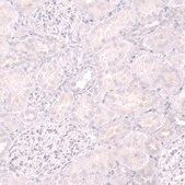 Monoclonal Anti-CD19 antibody produced in mouse Prestige Antibodies® Powered by Atlas Antibodies, clone CL15454, purified antibody (Protein A)
