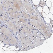 Anti-GNA15 antibody produced in rabbit Prestige Antibodies® Powered by Atlas Antibodies, affinity isolated antibody, buffered aqueous glycerol solution