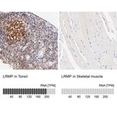 Anti-LRMP antibody produced in rabbit Prestige Antibodies&#174; Powered by Atlas Antibodies, affinity isolated antibody, buffered aqueous glycerol solution