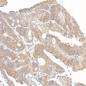 Anti-MUTA Antibody, clone 2V5O5, Rabbit Monoclonal