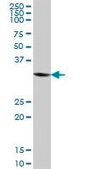 Anti-ANKRD1 antibody produced in mouse IgG fraction of antiserum, buffered aqueous solution