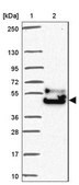 Anti-FAM149A antibody produced in rabbit Prestige Antibodies&#174; Powered by Atlas Antibodies, affinity isolated antibody, buffered aqueous glycerol solution