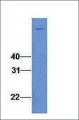 Anti-FOXK2 (AB1) antibody produced in rabbit affinity isolated antibody, lyophilized powder