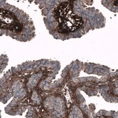 Monoclonal Anti-POSTN antibody produced in mouse Prestige Antibodies&#174; Powered by Atlas Antibodies, clone CL12090, purified immunoglobulin, buffered aqueous glycerol solution