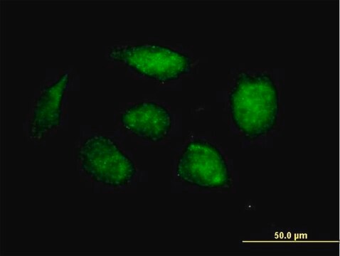 Anti-HOXB1 antibody produced in mouse purified immunoglobulin, buffered aqueous solution