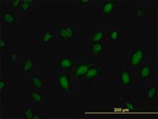 Monoclonal Anti-RNMT antibody produced in mouse clone 3H3-1D12, purified immunoglobulin, buffered aqueous solution