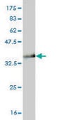 Monoclonal Anti-GTF3A antibody produced in mouse clone 3A1, purified immunoglobulin, buffered aqueous solution