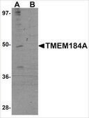 Anti-TMEM184A antibody produced in rabbit affinity isolated antibody, buffered aqueous solution