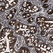 Anti-PASK antibody produced in rabbit Prestige Antibodies&#174; Powered by Atlas Antibodies, affinity isolated antibody, buffered aqueous glycerol solution