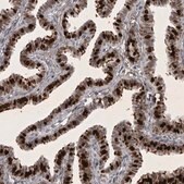 Anti-HMGN3 antibody produced in rabbit Prestige Antibodies® Powered by Atlas Antibodies, affinity isolated antibody, buffered aqueous glycerol solution