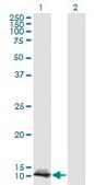 Monoclonal Anti-LGALS1, (N-terminal) antibody produced in mouse clone 1A8, purified immunoglobulin, buffered aqueous solution