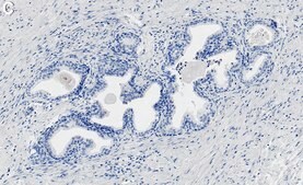 Anti-UGDH Antibody, clone 1F18 ZooMAb® Rabbit Monoclonal recombinant, expressed in HEK 293 cells