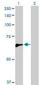 Anti-ARHGEF5, (N-terminal) antibody produced in rabbit purified immunoglobulin, buffered aqueous solution