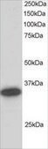 Anti-CBR1 antibody produced in goat affinity isolated antibody, buffered aqueous solution