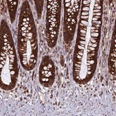 Anti-UBE3B antibody produced in rabbit Prestige Antibodies&#174; Powered by Atlas Antibodies, affinity isolated antibody, buffered aqueous glycerol solution