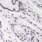 Anti-Acetyl-Histone H3-K18 antibody produced in rabbit
