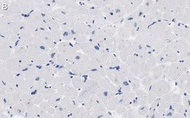 Anti-PDK4 Antibody, clone 2H5 ZooMAb® Rabbit Monoclonal recombinant, expressed in HEK 293 cells