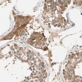 Anti-TDRP antibody produced in rabbit Prestige Antibodies® Powered by Atlas Antibodies, affinity isolated antibody, buffered aqueous glycerol solution