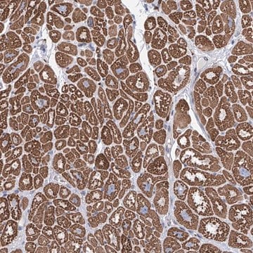 Anti-LCLAT1 antibody produced in rabbit Prestige Antibodies&#174; Powered by Atlas Antibodies, affinity isolated antibody, buffered aqueous glycerol solution