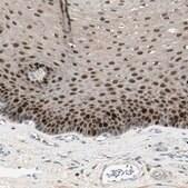 Anti-PITX1 antibody produced in rabbit Prestige Antibodies&#174; Powered by Atlas Antibodies, affinity isolated antibody, buffered aqueous glycerol solution