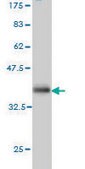 Monoclonal Anti-AKT3 antibody produced in mouse clone 6E10, purified immunoglobulin, buffered aqueous solution
