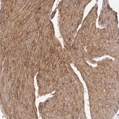 Anti-LAMA4 antibody produced in rabbit Prestige Antibodies&#174; Powered by Atlas Antibodies, affinity isolated antibody, buffered aqueous glycerol solution
