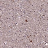 Anti-SPOCK2 antibody produced in rabbit Prestige Antibodies&#174; Powered by Atlas Antibodies, affinity isolated antibody, buffered aqueous glycerol solution