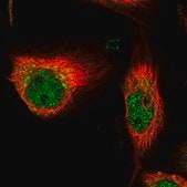 Anti-TUBD1 antibody produced in rabbit Prestige Antibodies&#174; Powered by Atlas Antibodies, affinity isolated antibody, buffered aqueous glycerol solution, Ab1