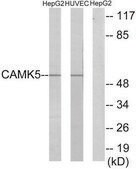 Anti-CAMK5 antibody produced in rabbit affinity isolated antibody
